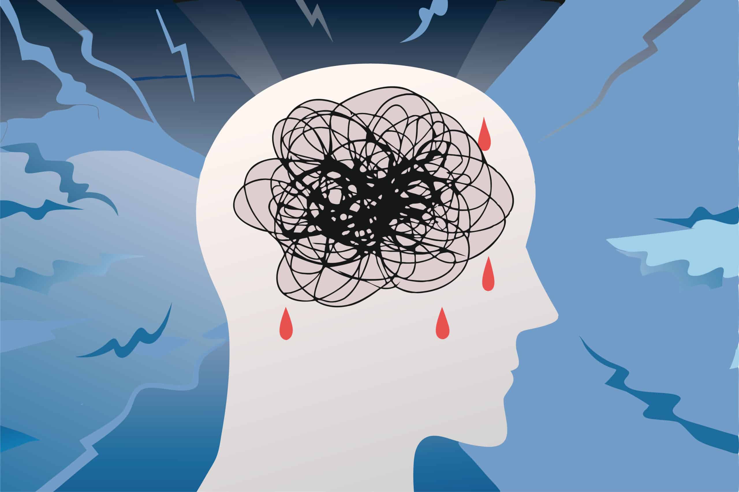 Irrégularité d’un placement en UMD : la mainlevée suppose une « atteinte aux droits » du malade